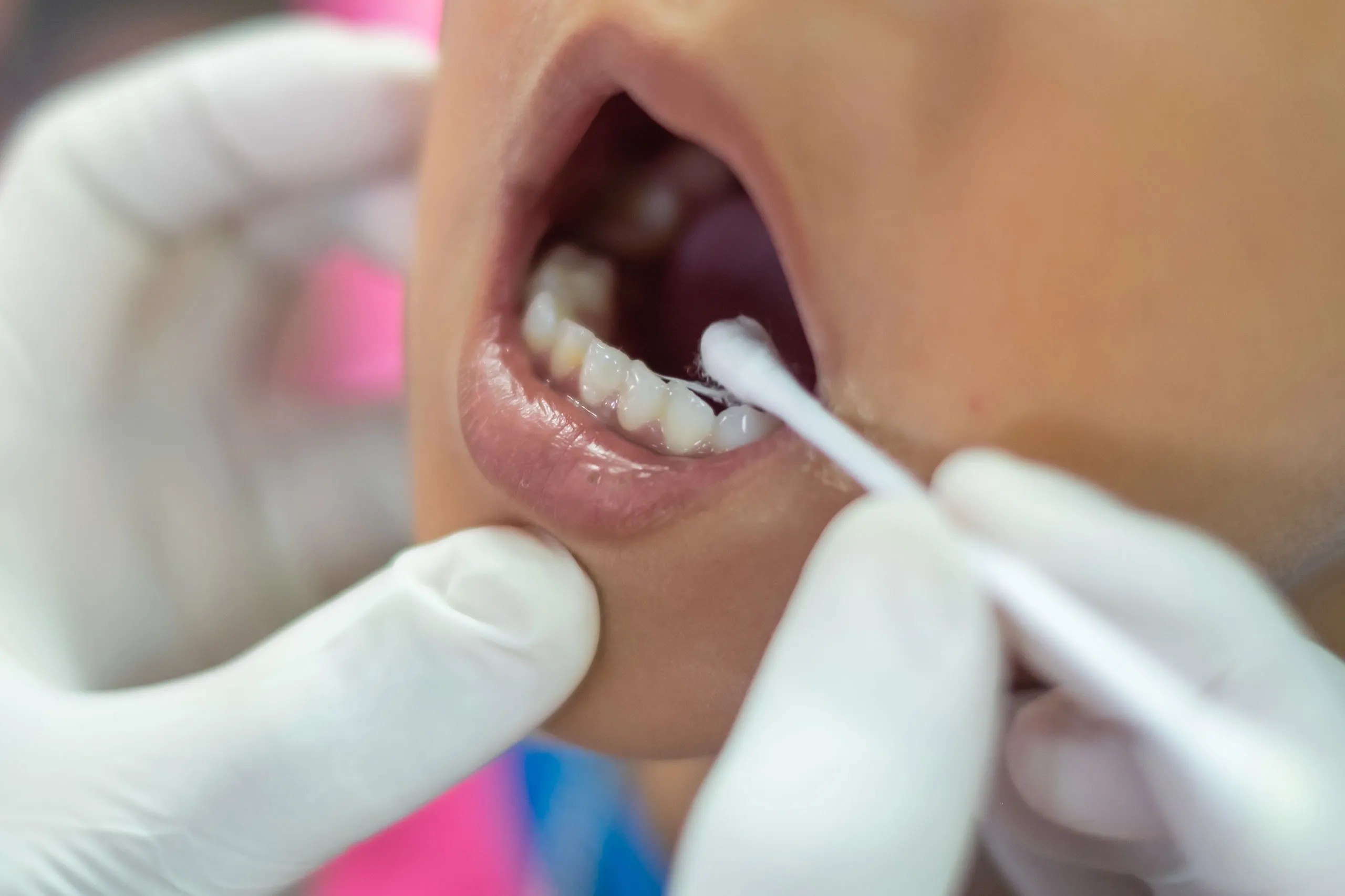 静脈内鎮静法とは