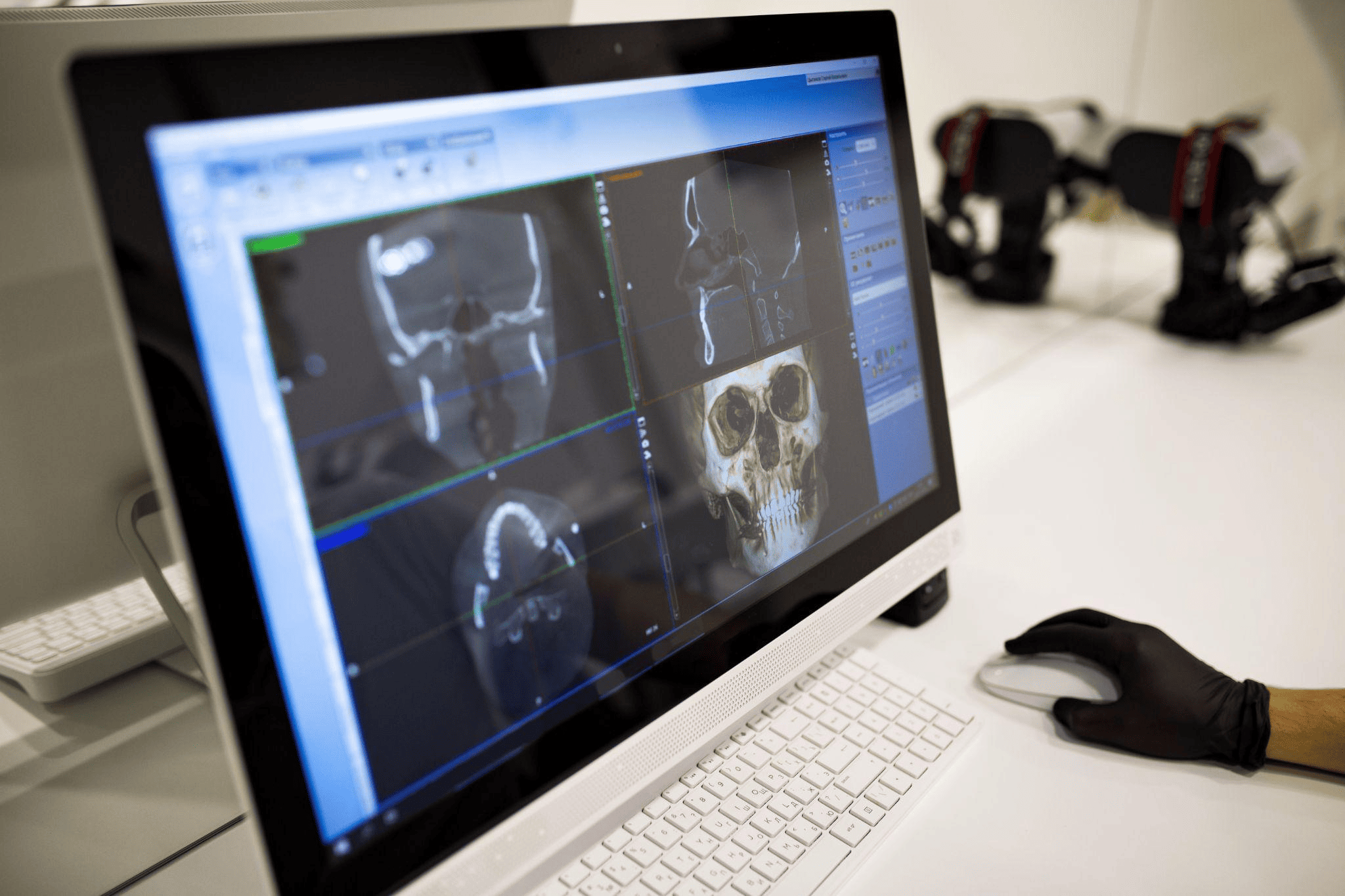 口腔外科で対応する治療内容